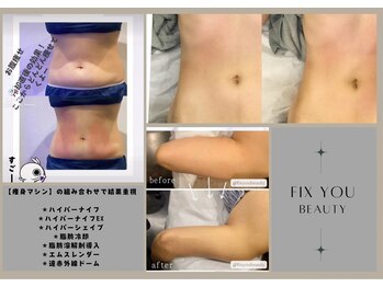 フィックスユー ビューティー(Fixyou BEAUTY)