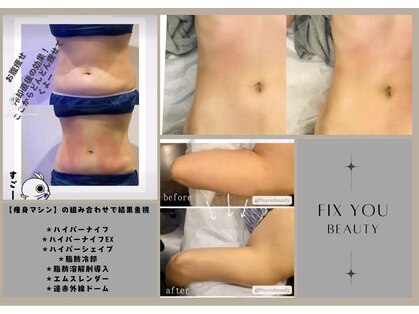 フィックスユー ビューティー(Fixyou BEAUTY)の写真