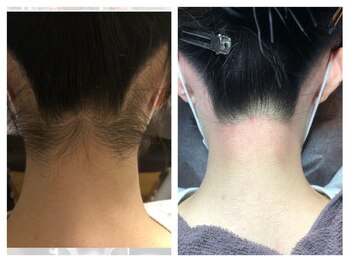 エムユー(Mu)/どっちがすきですか?