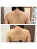 速攻痩せ/引き締め効果大】一回で結果がわかる！！1箇所5000ショット 5500円