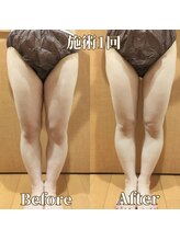 ヨサパーク サーナ 仙川(YOSA PARK Sana)/40代お客様ビフォー⇒アフター