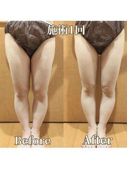 ヨサパーク サーナ 仙川(YOSA PARK Sana)/40代お客様ビフォー⇒アフター