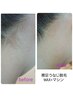【レディース脱毛】えりあしうなじWAX＆マシン　 ￥4400
