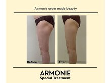 アルモニー(armonie)/下半身痩せ！