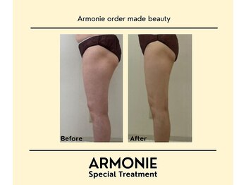 アルモニー(armonie)/下半身痩せ！