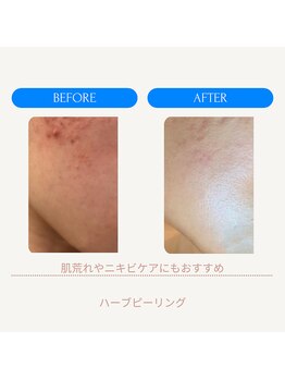 ムーンライズ(moonrise)/