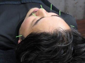 ケアフォー 西小山(Carefor)の写真/スマホやPCで酷使した目の疲れなどに◎頭痛・眼精疲労の原因となる辛い肩こり・首の痛みを根本改善！