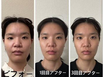 アクアナチュラ(ACQUANATURA)/来られる度笑顔に^_^