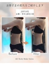 アンドユー(&U)/