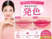 モエラビューティーサロン(Moela beauty salon)の雰囲気(くすみ・黒ずみのお悩みから解放!メイク時短にも◎)