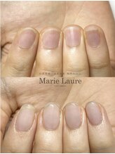 マリーロール 天王寺店(Marie Laure)/自爪育成/深爪矯正/ネイルケア