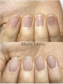 マリーロール 天王寺店(Marie Laure)/自爪育成/深爪矯正/ネイルケア