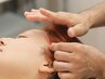 抗炎美容鍼プラン　～肌の問題を鎮め、内側から輝く美肌へ～