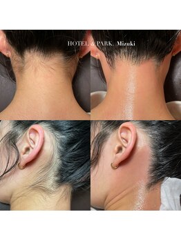 ホテルアンドパーク(HOTEL&PARK.)/うなじワックス脱毛