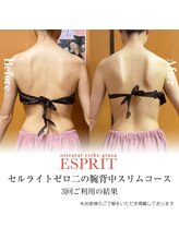 エスプリ 銀座店/二の腕スリム・銀座痩身