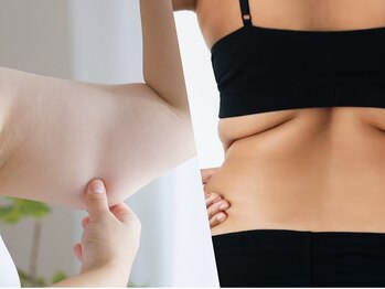 アイビー(aibe:)の写真/脱おばさん体型!ポッコリお腹&背肉脂肪撃退!今なら初回体験¥17,500→¥6,600でお得に痩身体験★