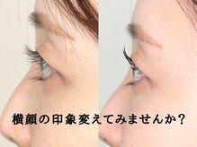 アルネ 大宮店(Arune)/