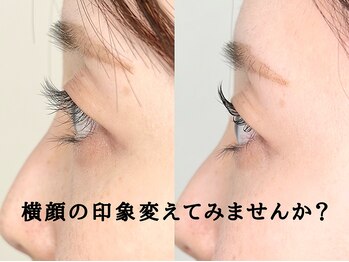 アルネ 大宮店(Arune)/