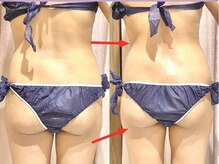 ソフィア(SOPHIA)の雰囲気（最新痩身高性能マシン【セルライトゼロ2】で本気のダイエット！）