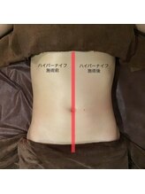 フローボディ 新山口店(flow BODY)/山口のエステはflow BODY