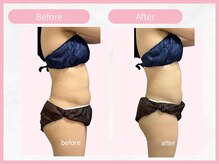 アールエイチビー 藤沢店(RHB)/