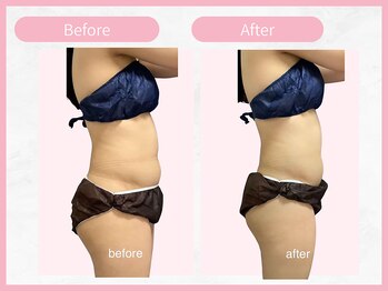 アールエイチビー 藤沢店(RHB)/