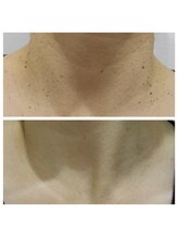 エトル(etole)/50代　お客様症例写真