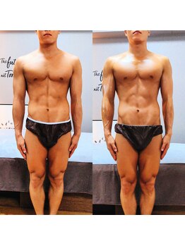 ブラグ(BRAG)/カット出し ビフォーアフター♪