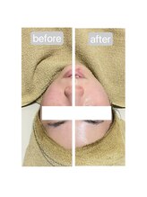 トランク(Trunk)/ハーブ×プラズマ