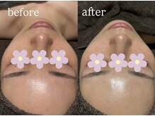 ビビ(Vivi)/ハーブでくすみ改善！！