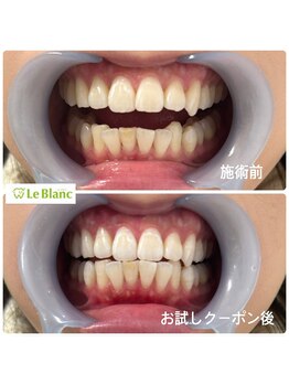 ルブラン 奈良店(Le Blanc)/学生様必見!!