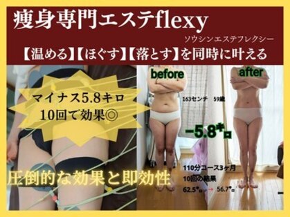 フレクシーの写真