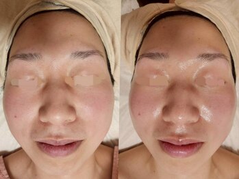 ロータスマップ(LOTUS MAP)/