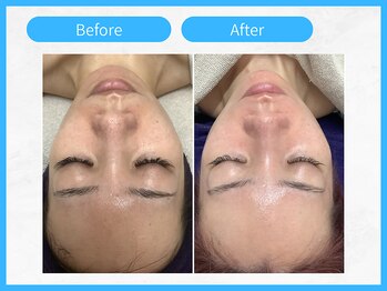 トウメイコガオ 横浜店/トウメイコガオ【ララピール】