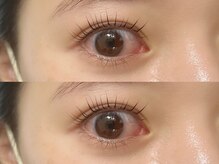 アイクイック 北千住店(Ai Quick)/パリジェンヌラッシュリフト