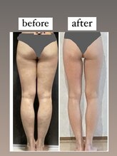 ザ エステティック福岡/リラインピラティス変化