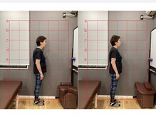 摂津本山駅前鍼灸整骨院/ビフォーアフターになります！