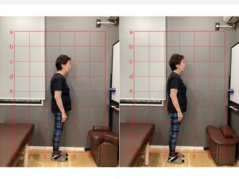 摂津本山駅前鍼灸整骨院/ビフォーアフターになります！