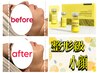 【韓国発フェイシャル！】話題のレモンボトル脂肪分解液の導入！¥25,000