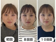 ラボーテヴェリテ(La Beaute Verite)の雰囲気（回数を重ねるごとにどんどん変わる◎通うのが楽しみに！）