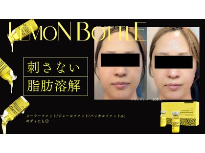スズ(SUZU)の写真