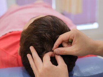 カルミア鍼灸接骨院/鍼施術(頭痛、自律神経)