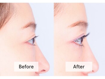 アンドミー 月島店(and me.)/エクステパーマ/まつげエクステ