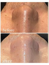 ルタンリッシュオム(Lutan Riche hom)/毛穴洗浄もできる！