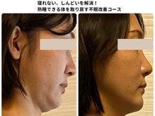 表情や姿勢も寝れるようになるだけで生き生きしてきます。