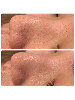 アイラッシュ ミル 御領店(eye lash Miru)/毛穴ケア