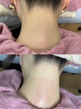 ラ フルール(La Fleur)/うなじワックス