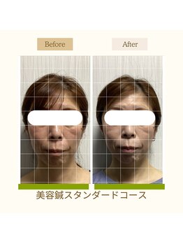 サロン ド ハリッシュ(Salon de HARISH)/血行が良くなり、顔の印象アップ