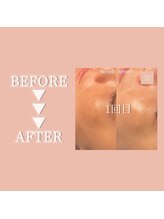 クリアラボ 豊中(Clear Lab)/Before&After