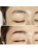 《ハリウッドブロウリフト》